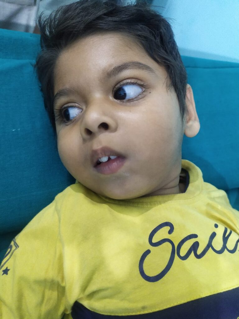 Normal Child Clinic, Autism, Epilepsy, ADHD, Speech Delay, Seizure, Hyperactive, Cerebral Palsy, Coma, Mental Health, Hydrocephalus, Raipur Centre, Child Clinic Near Bhatagaon Bus Stand, Pediatric Care Raipur, B-19 Radhaswami Nagar, Child Development Clinic Chhattisgarh