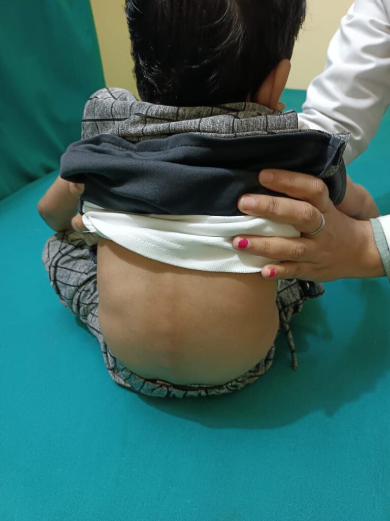 Normal Child Clinic, Autism, Epilepsy, ADHD, Speech Delay, Seizure, Hyperactive, Cerebral Palsy, Coma, Mental Health, Hydrocephalus, Raipur Centre, Child Clinic Near Bhatagaon Bus Stand, Pediatric Care Raipur, B-19 Radhaswami Nagar, Child Development Clinic Chhattisgarh