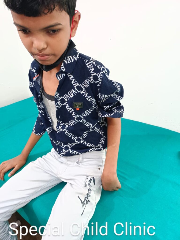Normal Child Clinic, Autism, Epilepsy, ADHD, Speech Delay, Seizure, Hyperactive, Cerebral Palsy, Coma, Mental Health, Hydrocephalus, Raipur Centre, Child Clinic Near Bhatagaon Bus Stand, Pediatric Care Raipur, B-19 Radhaswami Nagar, Child Development Clinic Chhattisgarh