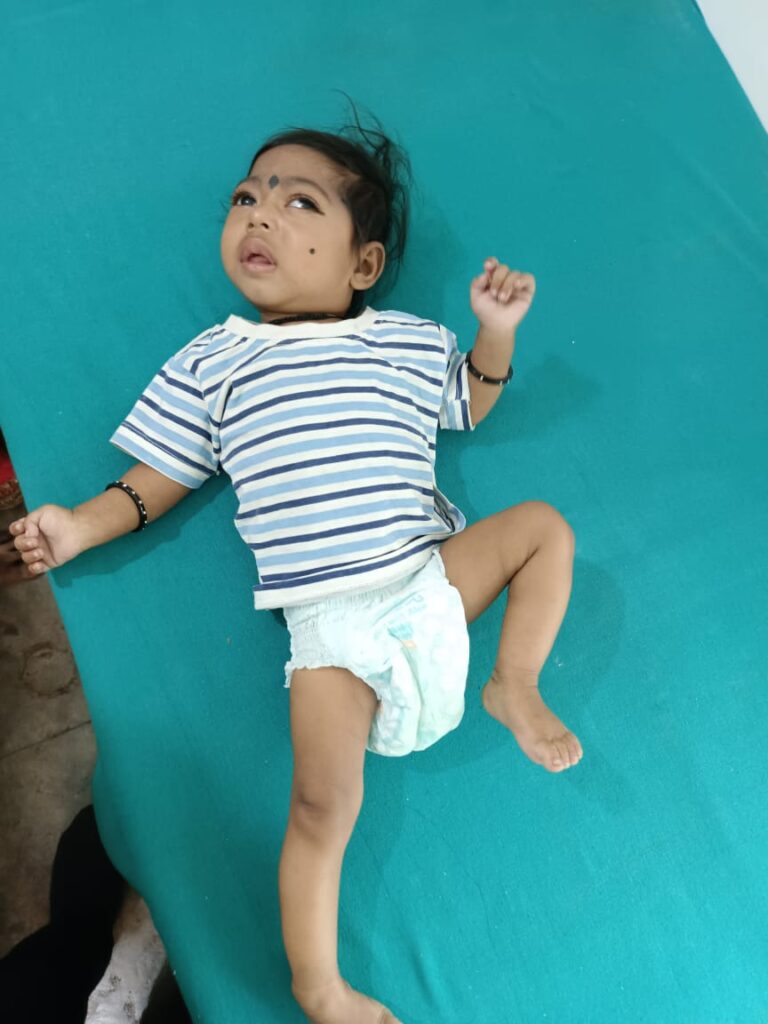 Normal Child Clinic, Autism, Epilepsy, ADHD, Speech Delay, Seizure, Hyperactive, Cerebral Palsy, Coma, Mental Health, Hydrocephalus, Raipur Centre, Child Clinic Near Bhatagaon Bus Stand, Pediatric Care Raipur, B-19 Radhaswami Nagar, Child Development Clinic Chhattisgarh