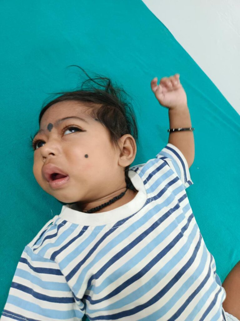 Normal Child Clinic, Autism, Epilepsy, ADHD, Speech Delay, Seizure, Hyperactive, Cerebral Palsy, Coma, Mental Health, Hydrocephalus, Raipur Centre, Child Clinic Near Bhatagaon Bus Stand, Pediatric Care Raipur, B-19 Radhaswami Nagar, Child Development Clinic Chhattisgarh