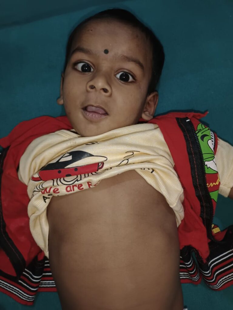 Normal Child Clinic, Autism, Epilepsy, ADHD, Speech Delay, Seizure, Hyperactive, Cerebral Palsy, Coma, Mental Health, Hydrocephalus, Raipur Centre, Child Clinic Near Bhatagaon Bus Stand, Pediatric Care Raipur, B-19 Radhaswami Nagar, Child Development Clinic Chhattisgarh