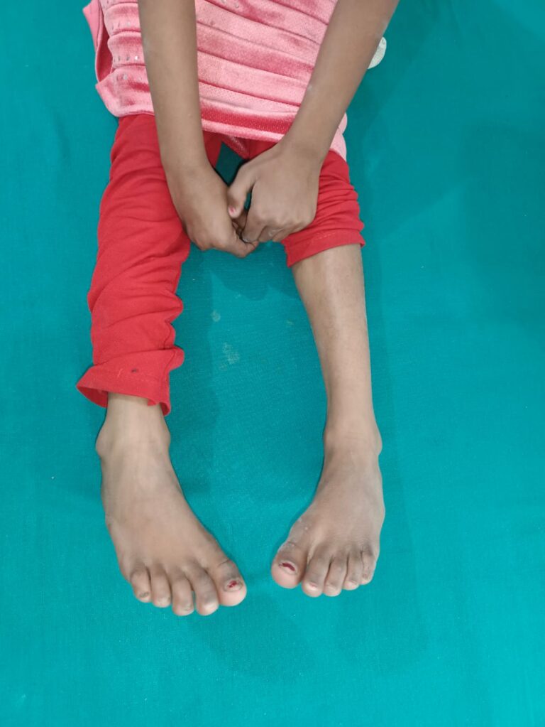 Normal Child Clinic, Autism, Epilepsy, ADHD, Speech Delay, Seizure, Hyperactive, Cerebral Palsy, Coma, Mental Health, Hydrocephalus, Raipur Centre, Child Clinic Near Bhatagaon Bus Stand, Pediatric Care Raipur, B-19 Radhaswami Nagar, Child Development Clinic Chhattisgarh