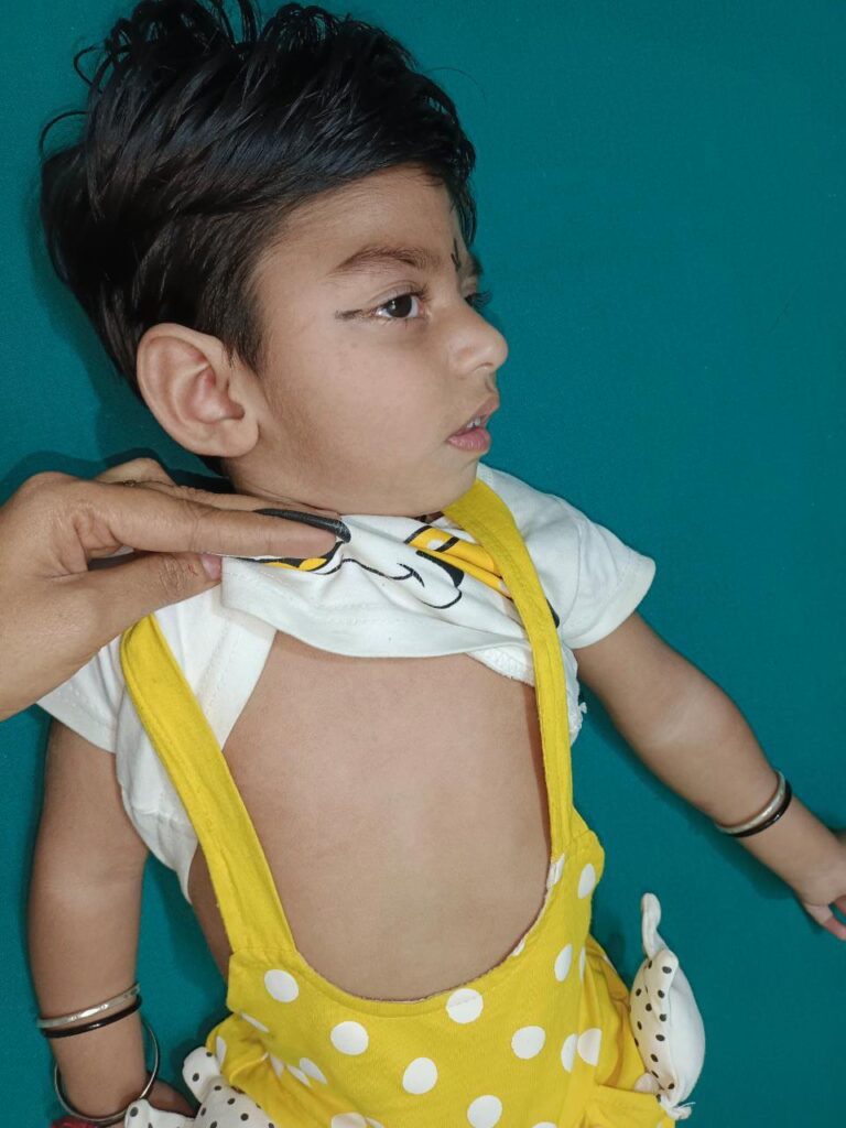 Normal Child Clinic, Autism, Epilepsy, ADHD, Speech Delay, Seizure, Hyperactive, Cerebral Palsy, Coma, Mental Health, Hydrocephalus, Raipur Centre, Child Clinic Near Bhatagaon Bus Stand, Pediatric Care Raipur, B-19 Radhaswami Nagar, Child Development Clinic Chhattisgarh