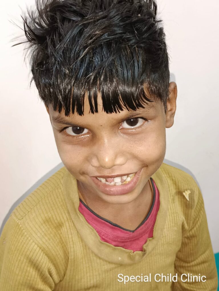 Normal Child Clinic, Autism, Epilepsy, ADHD, Speech Delay, Seizure, Hyperactive, Cerebral Palsy, Coma, Mental Health, Hydrocephalus, Raipur Centre, Child Clinic Near Bhatagaon Bus Stand, Pediatric Care Raipur, B-19 Radhaswami Nagar, Child Development Clinic Chhattisgarh