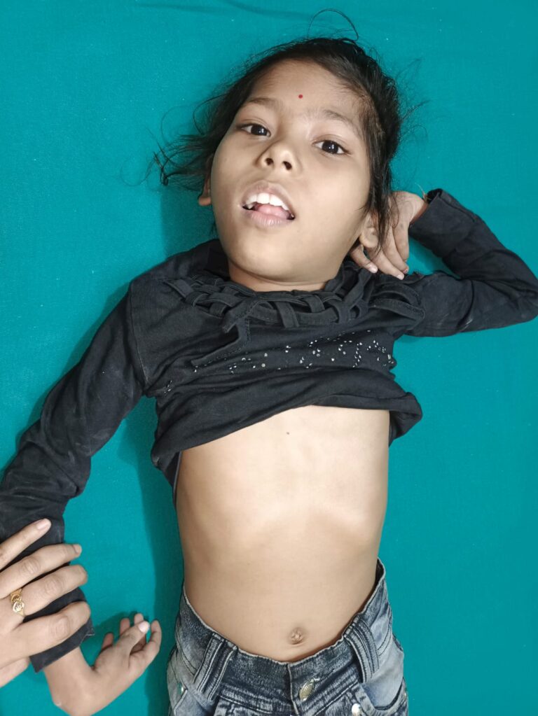 Normal Child Clinic, Autism, Epilepsy, ADHD, Speech Delay, Seizure, Hyperactive, Cerebral Palsy, Coma, Mental Health, Hydrocephalus, Raipur Centre, Child Clinic Near Bhatagaon Bus Stand, Pediatric Care Raipur, B-19 Radhaswami Nagar, Child Development Clinic Chhattisgarh