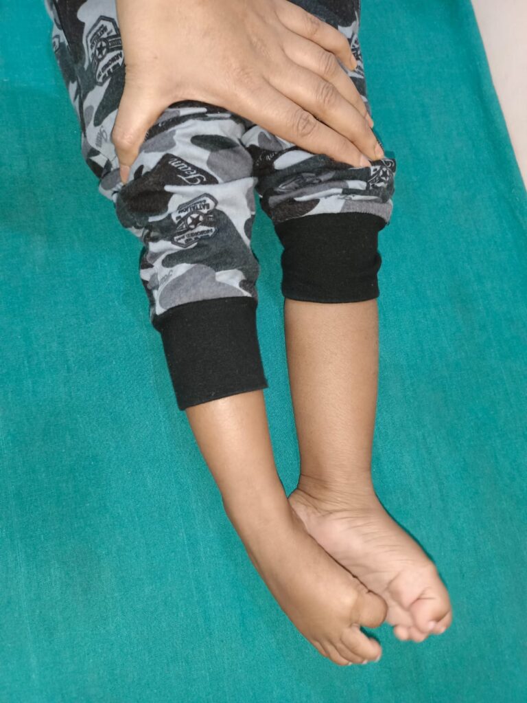 Normal Child Clinic, Autism, Epilepsy, ADHD, Speech Delay, Seizure, Hyperactive, Cerebral Palsy, Coma, Mental Health, Hydrocephalus, Raipur Centre, Child Clinic Near Bhatagaon Bus Stand, Pediatric Care Raipur, B-19 Radhaswami Nagar, Child Development Clinic Chhattisgarh