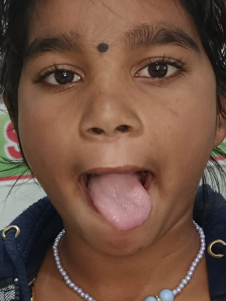 Normal Child Clinic, Autism, Epilepsy, ADHD, Speech Delay, Seizure, Hyperactive, Cerebral Palsy, Coma, Mental Health, Hydrocephalus, Raipur Centre, Child Clinic Near Bhatagaon Bus Stand, Pediatric Care Raipur, B-19 Radhaswami Nagar, Child Development Clinic Chhattisgarh