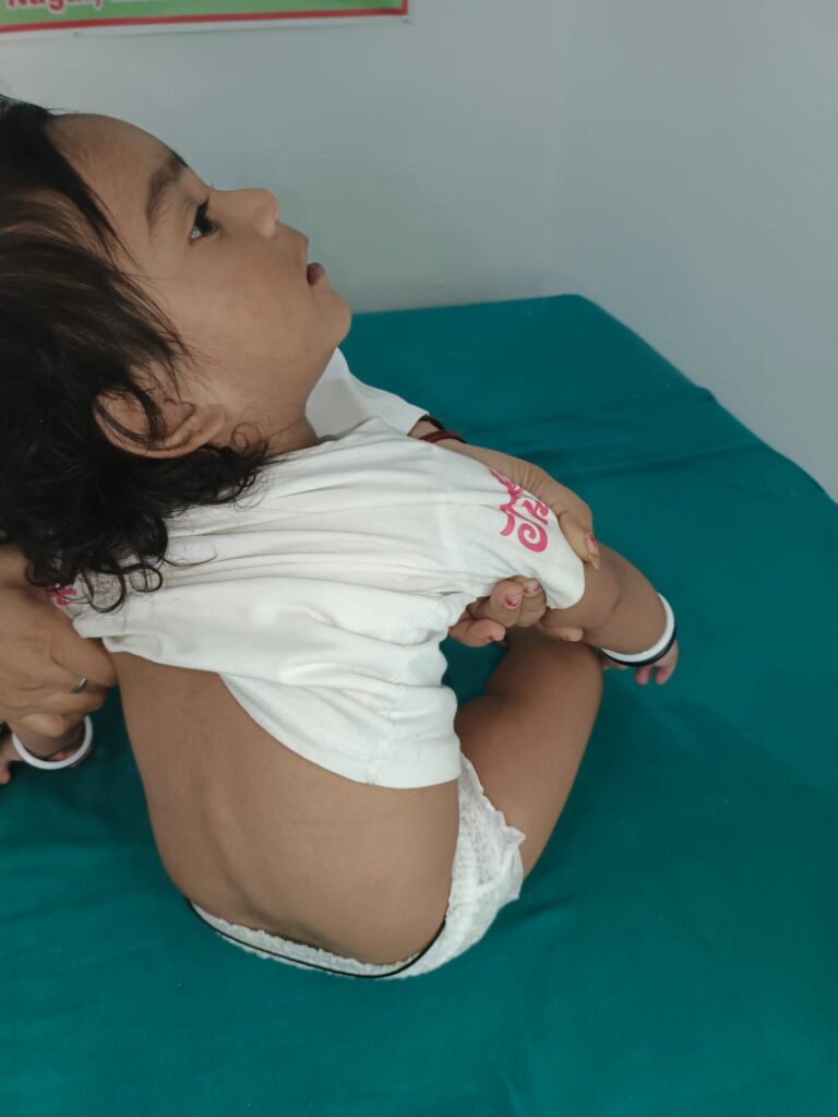 Normal Child Clinic, Autism, Epilepsy, ADHD, Speech Delay, Seizure, Hyperactive, Cerebral Palsy, Coma, Mental Health, Hydrocephalus, Raipur Centre, Child Clinic Near Bhatagaon Bus Stand, Pediatric Care Raipur, B-19 Radhaswami Nagar, Child Development Clinic Chhattisgarh