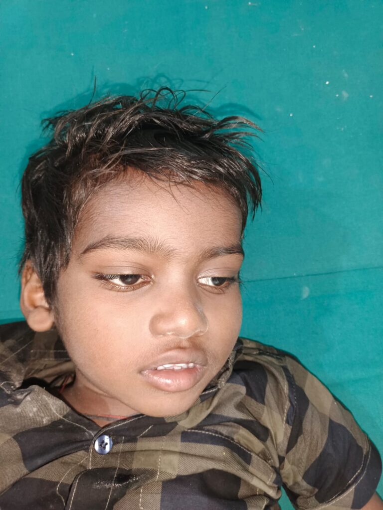 Normal Child Clinic, Autism, Epilepsy, ADHD, Speech Delay, Seizure, Hyperactive, Cerebral Palsy, Coma, Mental Health, Hydrocephalus, Raipur Centre, Child Clinic Near Bhatagaon Bus Stand, Pediatric Care Raipur, B-19 Radhaswami Nagar, Child Development Clinic Chhattisgarh