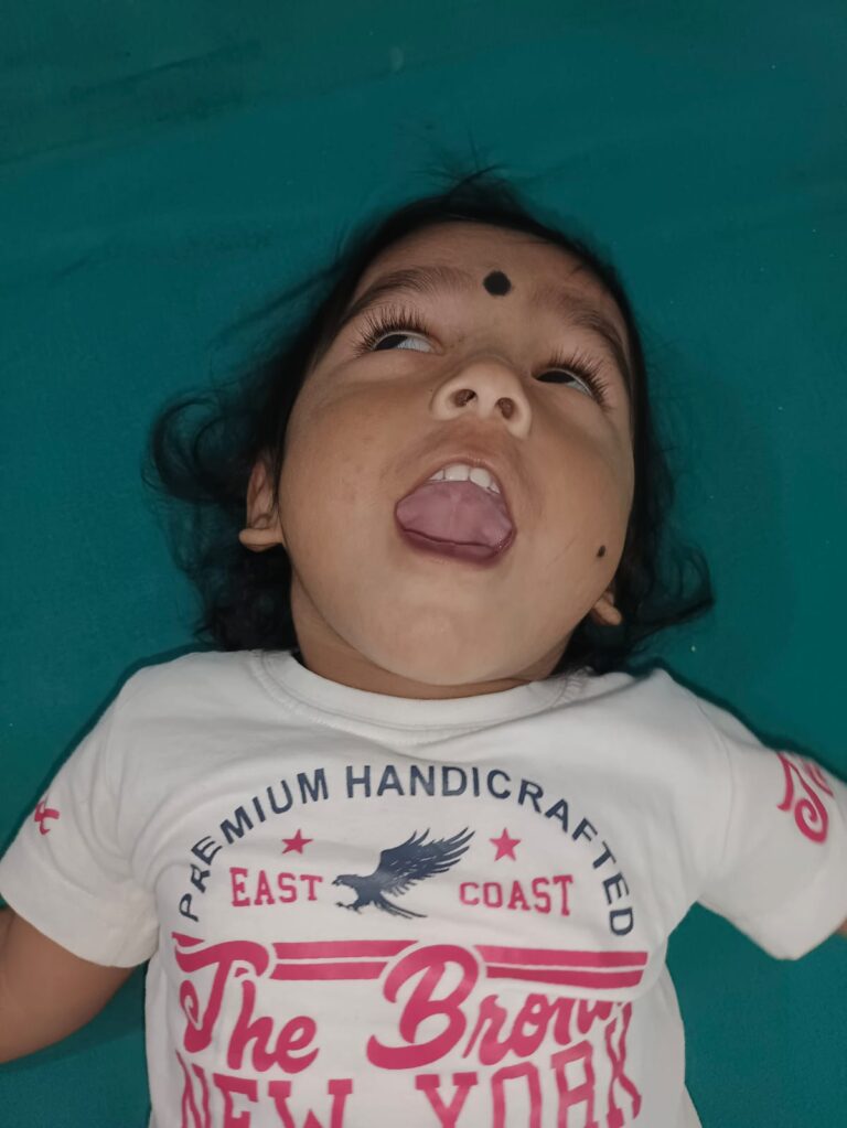 Normal Child Clinic, Autism, Epilepsy, ADHD, Speech Delay, Seizure, Hyperactive, Cerebral Palsy, Coma, Mental Health, Hydrocephalus, Raipur Centre, Child Clinic Near Bhatagaon Bus Stand, Pediatric Care Raipur, B-19 Radhaswami Nagar, Child Development Clinic Chhattisgarh